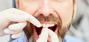 Periodoncias4