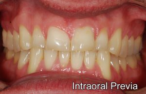 intraoralprevia1