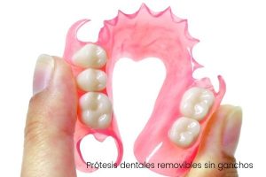 protesis-dentales-removibles-sin-ganchos
