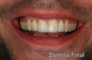sonrisafinalok