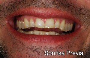 sonrisaprevia1